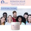 e70 Rosacea Solve - Redness Relief Cream - Face Moisturizer For Rosacea & Acne Prone Skin - Sensitive Skin Care With Organic Ingredients, Almond Oil, Licorice & Chamomile Extracts - No Parabens