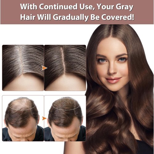 2 PCS Organic Hair Darkening Shampoo Bar, Harishow Hair Shampoo Soap for Gray Hair, Hira Shouwu Darkening Shampoo Bar, Grey Hair Removal Soap Damaged Hair Unisex, Promotes Hair Growth