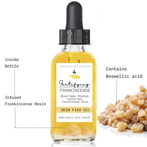 Fortifying Frankincense Resin Infused 100% Organic Black Seed, Rosehip & Castor Oils for Face Miracle Anti-Aging Facial Moisturizer Cold Pressed Oils Natural Serum Skincare Hydrates Skin