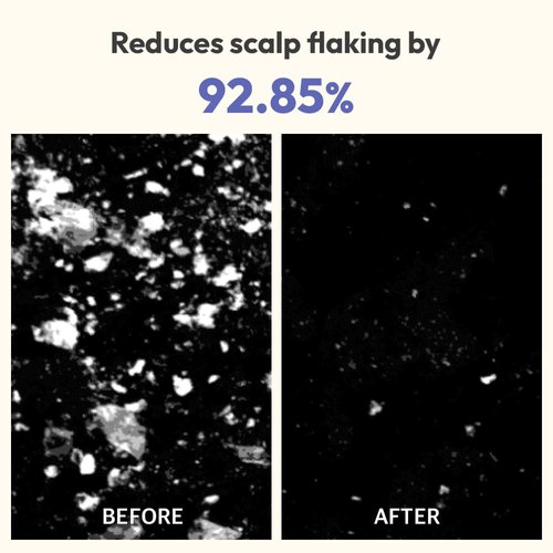 BEIGIC Volumizing Shampooing Scrub | Korean Hair Care Scalp Exfoliator Scrub w/Sacha Inchi Seed Oil, Sea Salt & Mint Menthol | Vegan Hair & Scalp Scrub Clarifying Shampoo | Hair Scrub (1.76 oz)