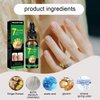 1 Pcs 7 Days Ginger Nail Treatment Nail Serum, Ginger Cuticle Care Oil for Nails, GingerNail Care Essential Oil for Strengthen & Promote Nails Growth