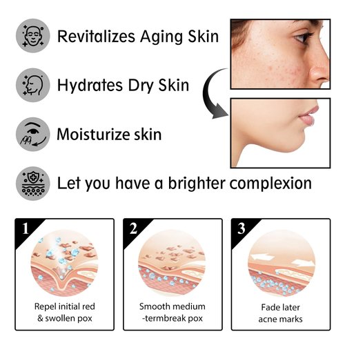 Loske Snail Mucin Cream, 92% Pure Snail Slime Extract Moisturizer for Face and Body, Snail Mucin Essence 92% Snail Slime Face Cream, Face Cream for Moisturizing Repairing