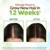 MAMAEARTH Rosemary Hair Oil with Rosemary & Methi Dana - 150 ml | Controls Hair Fall | Strengthens Hair