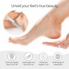 Pop Sonic Nano Glass Foot File (1 Unit) | Foot Callous Removal for Smooth, Soft Feet | Foot Scraper for Dead Skin Remover | Perfect Pedicure Tools at Home or Salon Use (Marble)