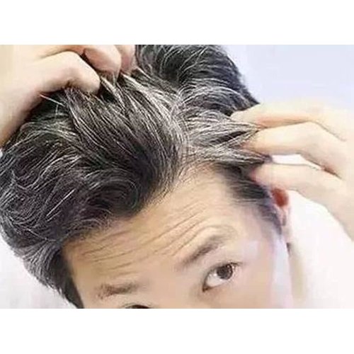 MOKERU Ginger Black Hair Shampoo Magic 5 minutes natural black hair dye Component Healthier Smell More Fragrant Longer-Lasting Color