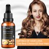 Newvenper Ginger Hair Growth Serum for Hair Regrowth, Hair Thickening Serum for Thinner/Balding/Repairs Hair Follicles, Anti Hair Loss Treatment for Men and Women