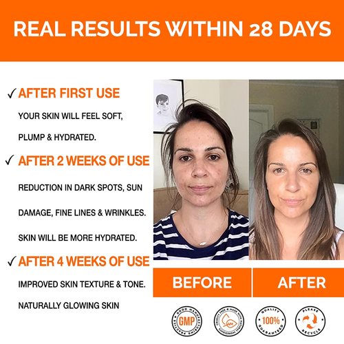 PREMIUM Vitamin C Serum For Face with Hyaluronic Acid Serum - Anti Ageing & Anti Wrinkle Serum - This Vegan Vitamin C Serum Will Plump, Hydrate & Brighten Skin While Filling In Those Fine Lines & Wrinkles. See Results Or Your Money Back!