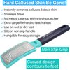 Onyx Professional Curved Foot File + Callus Remover, XL Double-Sided Ergonomic Pedicure File & Stainless Steel Foot Rasp, Effective Foot Exfoliator & Dead Skin Remover for Softer, Smoother Feet