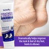 TriDerma Cracked & Crusty™ Healthy Foot Cream Moisturizes, Softens and Heals Dry Feet, Cracked Heels and Dry Elbows with Salicylic Acid, Urea, Shea Butter, AP4 Aloe and Vitamins, 4.2 Ounces