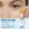 LA.PERSONAL Stye Eye Treatment, Chalazion Remover, Eye Serum for Styes Chalazion and Blepharitis Treatment, with Avocado oil, Sea buckthorn oil & Caffeine 1.01 Fl oz/30 Ml