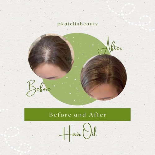 Katelia Beauty 4-in-1 Hair Oil (Scalp, Hair, Brow, & Beard) a Multi-Purpose, All-in-One Hair Growth Treatment for Longer, Stronger, & Healthier Hair, Anti-Hair Loss, Promotes Hair Growth, 30 ml