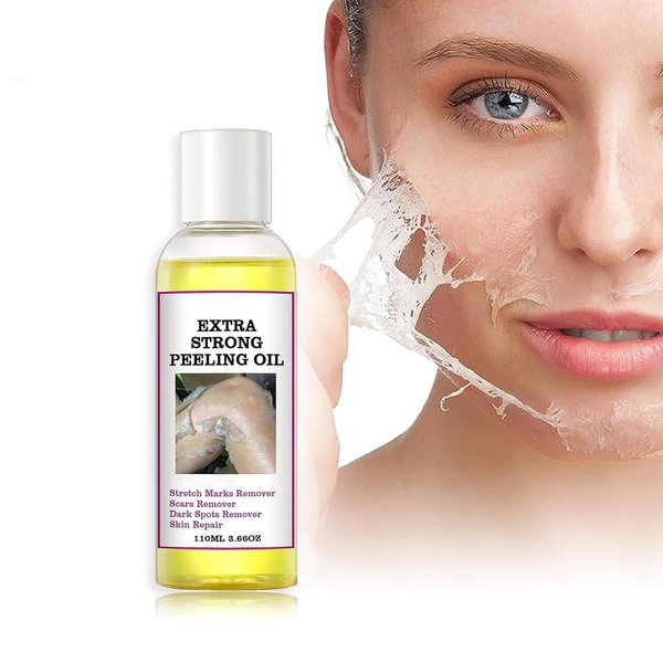 Yellow Peeling Oil, Peeling Oil for Dark Skin, Strong Peeling Oil Extra Strength, Exfoliating Peeling Solution for Body All Skin Type Dead Skin Remover (3.87 Fl Oz / 110ML)