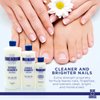 Blue Cross Professional Nail Care, Hydrating, Moisturizing, Strengthening Liquid Cuticle Remover + Softener with Lanolin for Brittle Nails, Hang Nails + Dry Cuticles, Made in USA, 6 ounce
