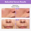 TOSOWOONG Bakuchiol Serum, 5,000ppm Bakuchiol, Anti-Aging, Pore Minimizer for Face, Hydrating Glow Serum, Facial Moisturizer, Active Skin Repair, Glass Skin, Korean Skincare, 30ml, 1.01 fl. oz.