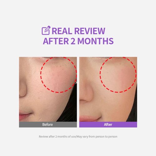 SUNGBOON EDITOR Meoru Podo Vita C Dark Spot Cream | Facial Moisturizer for Brightening Dark Spots, Correcting blemishes, Soothing | Vitamin C, Niacinamide, Hyaluronic Acid, Cica | Korean Skincare