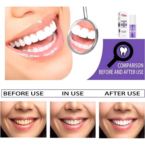 Purple Toothpaste for Teeth Whitening - Color Corrector & Stain Removal - Teeth Whitening Booster by ITZZO