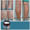 jeosisy Varicose Vein Cream for Legs - Varicose Veins Cream, Varicose & Spider Veins Soothing Leg Cream for Women Men