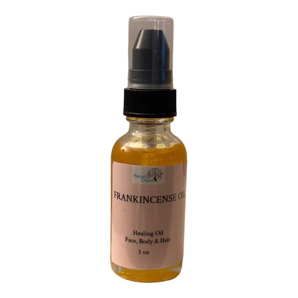 Frankincense Face Oil - Nourish, Tighten & Soothe Blemishes for Radiant Skin - 1oz