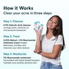 MDacne 3 Step Retinol Acne Kit - Retinol Cream 0.25%, Salicylic Acid Cleanser, Niacinamide Moisturizer - Plant-Based kit for Hormonal Acne, Blemishes, Wrinkles, 60 Day Acne Kit + Pimple Patch Gift