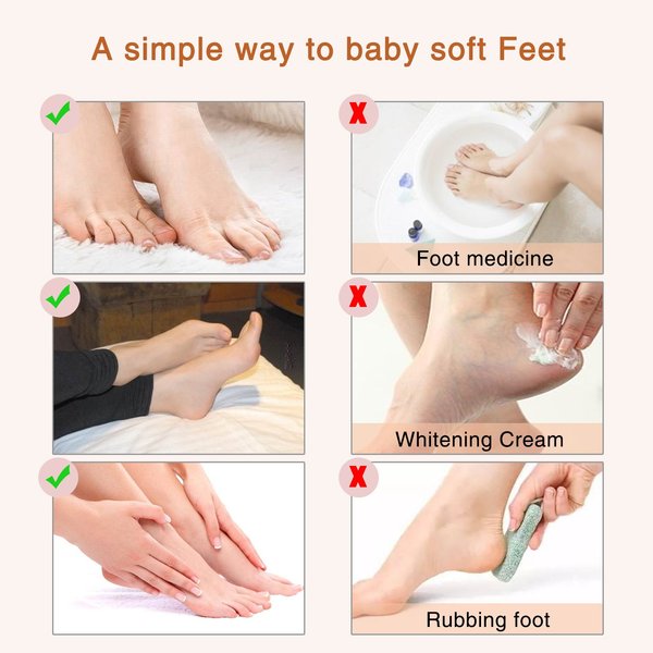 ALIVER Foot Peel Mask (5 pack), Exfoliate Dead Skin & Calluses,Natural Moisturizing Treatment Repair Cracked and Rough Heels, Baby Soft Smooth Touch Feet
