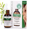 Advanced Clinicals Tea Tree Oil For Skin | Acne Patch Vegan Facial Serum | Targets Redness, Bumps, Acne Scars | Vegan 100% Organic Pure Tea Tree Oil For Face W/Vitamin E & Witch Hazel, 1.8 Fl Oz