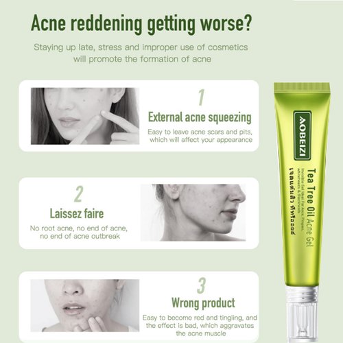 gcdat Tea Tree Oil Acne Gel For Acne Acne Removal Cream Skin Repairing Moisturizing Acne Spots Acne Treatment Blackhead Removing Cream, 20g