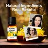 Kukka Ylang-Ylang Essential Oil for Diffuser- 100% Natural Therapeutic Grade Ylang Ylang Essential Oil for Skin - Ylang Ylang Oil for Hair Growth & Aromatherapy (0.34 fl Oz)