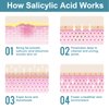 Salicylic Acid Powder (4.58 oz/130 g), Ultra Pure Cosmetic Grade Original Ingredients with no Additives, BHA Exfoliant for DIY Cleanser, Toner, Shampoo, Body Wash, Lotion