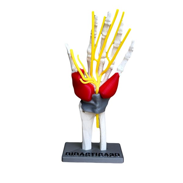Didactica3d Carpal Tunnel Syndrome Model, Hand and Wrist Model for Anatomy and Physiology Education, Anatomy Model for Doctor Offices, Medical Study Supplies (7 in - 18cm)