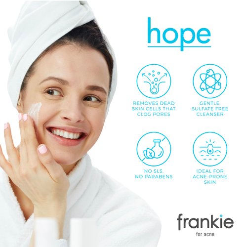 FP Skin Frankie for Acne Glycolic Acid Face Wash for Oily Skin with Activated Charcoal, Green Tea Extract and Hyaluronic Acid - Clarifying Without Drying 4 Oz/120ml