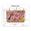 GPI Anatomicals - Skin Acne Model, Cross-Section Showing Normal and Common Acne-Riddled Skin for Human Anatomy, Physiology Education, Anatomy Model for Doctor's Office, Medical Learning Resources