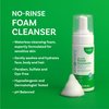 SKINCENTRY No-Rinse Foam Cleanser, Hospital Grade Total Hair Shampoo & Body Wash, Waterless Cleanser, Hypoallergenic, Dry Skin, Paraben, Sulfate, and Dye Free (4 oz.)