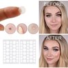 BUPY Acne Patch for Face, Pimple Patch, Tea Tree Oil Hydrocolloid Patch, 72 Counts Spot Stickers for Face, 2 Size (8mm + 12mm)