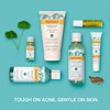 Burt's Bees Natural Acne Solutions Purifying Gel Cleanser, Salicylic Acid Acne Treatment with Soothing Cica, 98% Natural Origin, 5 Fluid Ounces (Package May Vary)