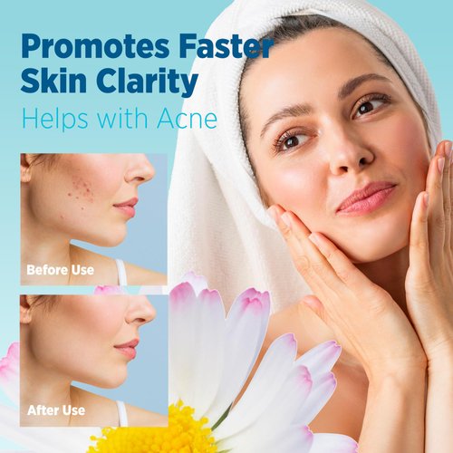 Roycederm Sulfur Soap for Acne Support: Sulfur Face Wash Bar for Sensitive Skin and Blemish-Prone Areas - Sulfur Body Cleanser with 10% Volcanic Sulfur, Tea Tree Oil - 2 Bars