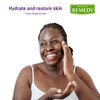Medline Remedy Essentials Moisturizing Body Lotion (2 oz Bottle), Unscented, Travel-Size, Hydrating, Non-Greasy, For Dry Skin, Hypoallergenic, Men, Women, Elderly