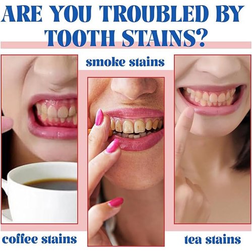 Niacinamide Whitening Toothpaste, Easilyous Radiant Whitening Toothpaste,Fresh Breath,Remove Tooth Stains, 2 Pack