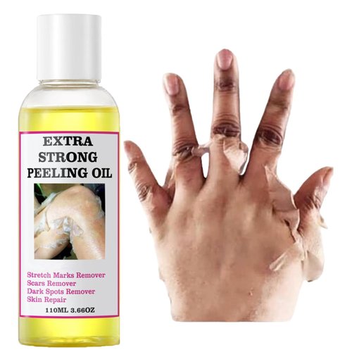 Peeling Oil for Dark Skin, Yellow Peeling Oil, Extra Strong Peeling Oil, Exfoliating Peeling Solution for Body All Skin Type -110ML/3.88 OZ