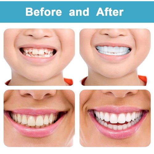 Denture Teeth Temporary Fake Teeth Snap On Top and Bottom Teeth for Men and Women, Cover The Imperfect Teeth,Fix Confident Smile