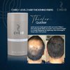 Cheio - Hair Thickening Fibers - 30g - Level 2 (Medium Brown) - Keratin Fibers for Bald Spots & Thinning Hair for Men and Women - Covers Spots in Seconds - Quick Solution for Hair Loss