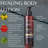 RD Alchemy - Healing Body Lotion - Best Lotion for Joint Pain, Arthritic Hands, Locked Shoulder, Tennis Elbow, and more Joint or Soft Tissue Injuries due to Chronic, Repetitive Motion.