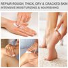 Urea Cream 40 Percent - Foot & Hand Cream, for Dry, Cracked Heels, Feet, Knees, Elbows, and Hands,Callus Remover,Maximum Strength Urea Lotion for Softening and Moisturizing