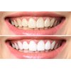 Dr. George's Dental Whitening Gel with Instructions