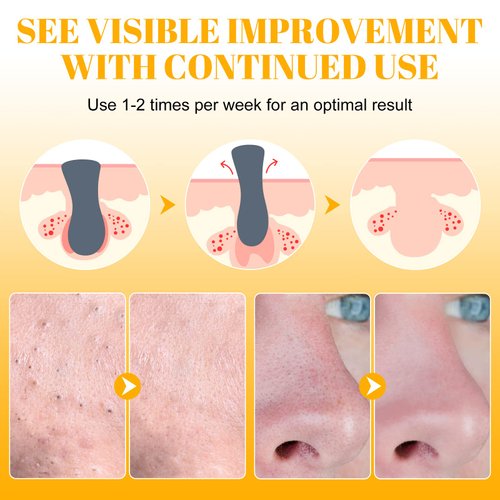 Blackhead Remover Strips(80pcs), Nose Pore Strips for Blackheads Remover, Skincare & Deep Cleansing Nose Strips Blackhead Remover