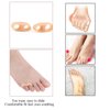 Yimanduo 10 Pcs Gel Little Toe Buddy Toe Corrector and Toe Straightener,Tailor's Bunion Pads Soft Gel Bunionette Pad Toe Protector Tailors Bunion Pain Relief