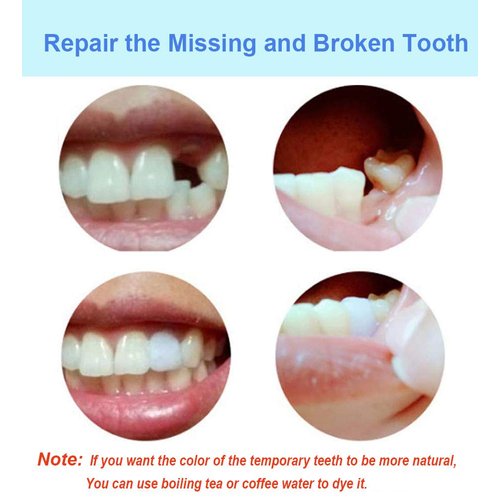 Tooth Filling Thermal Beads Do it Yourself Moldable False Teeth for Temporary Tooth Repair the Missing and Broken Tooth Replacement Kit(2 pack)
