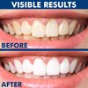 SmileWhite Teeth Whitening Pen (4 Pcs), Maximum Strenght Teeth Whitening, Teeth Whitening Kit, Effective, Painless, Non Sensitive, Travel Friendly, Natural White Smile, Natural Mint Flavor