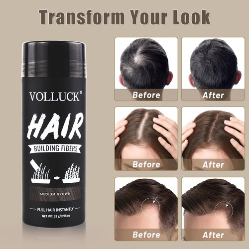 Hair Fibers for Thinning Hair for Women and Men, Hair Color for Gray Hair Coverage Thicker Fuller Hair Loss Instantly Hair Building Fibers Root Touch Up Natural Formula 28g (Medium Brown)