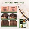 Aeshory Rosemary Castor Hair Oil - 5 IN 1 Hair Oil with Castor, Argan, Vitamin E, Avocado & Rosemary Oil for Hair Growth | Hair Strengthening Treatment | Nourishing & Volumizing 3.38 fl oz