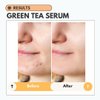 Skin Friendly Solutions Clarifying Green Tea Hyaluronic Acid Serum for red light therapy with Niacinamide - Skin Repairing and Clarifying Face Serum
